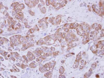 Immunohistochemistry-Paraffin: TIP30 Antibody [NBP2-20646]