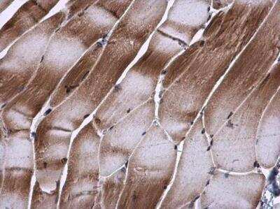 Immunohistochemistry-Paraffin: TIP30 Antibody [NBP2-20646]