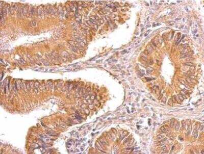 Immunohistochemistry-Paraffin: TIP30 Antibody [NBP2-20646]