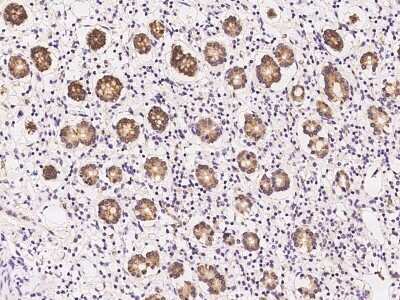 Immunohistochemistry-Paraffin: TIP30 Antibody [NBP2-98510]
