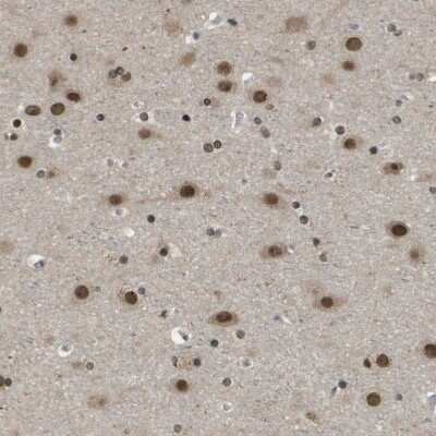 Immunohistochemistry-Paraffin: TIP60 Antibody [NBP1-85482]