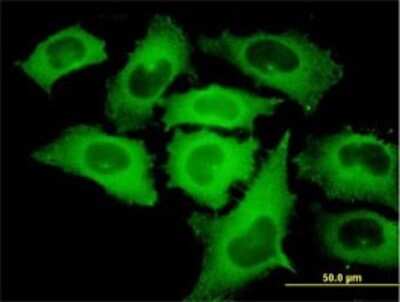 Immunocytochemistry/ Immunofluorescence: TIPIN Antibody (1G11) [H00054962-M01]