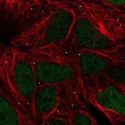 Immunocytochemistry/ Immunofluorescence: TIPIN Antibody [NBP2-38860]