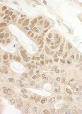 Immunohistochemistry-Paraffin: TIPRL Antibody [NB100-1815]