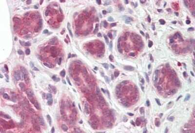 Immunohistochemistry-Paraffin: TIPRL Antibody [NBP1-51995]