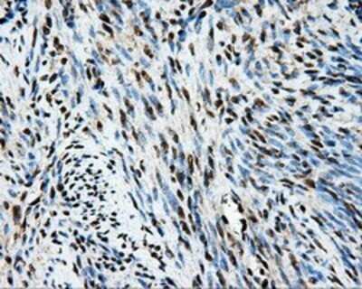 Immunohistochemistry: TIPRL Antibody (OTI3D11) - Azide and BSA Free [NBP2-74529]