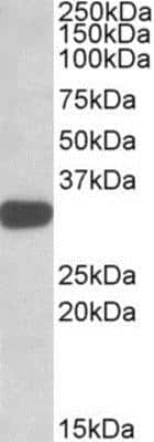 Western Blot: TIPRL Antibody [NBP1-51995]