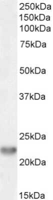 Western Blot: TIRAP Antibody [NB100-2823]