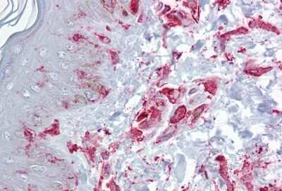 Immunohistochemistry: TIS11D Antibody [NBP2-83654]