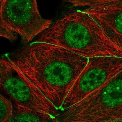 Immunocytochemistry/ Immunofluorescence: TJP3 Antibody [NBP2-56794]