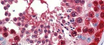 Immunohistochemistry-Paraffin: TKTL1 Antibody [NBP1-54864]