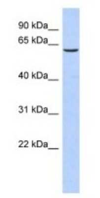 Western Blot: TKTL1 Antibody [NBP1-54864]