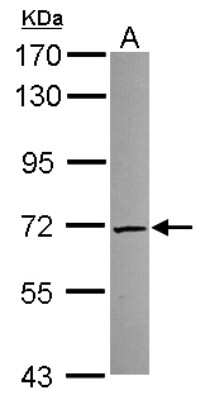 Western Blot: TKTL2 Antibody [NBP2-20650]