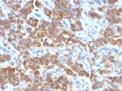 Immunohistochemistry-Paraffin: TL1A/TNFSF15 Antibody (VEGI/1283) - Azide and BSA Free [NBP2-54513]