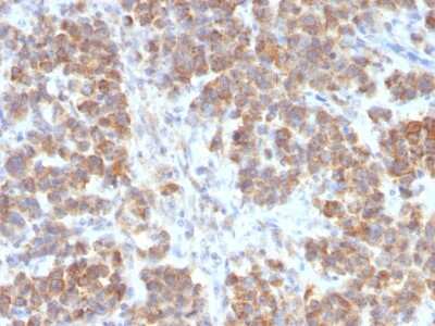 Immunohistochemistry-Paraffin: TL1A/TNFSF15 Antibody (VEGI/2052R) [NBP3-07481]