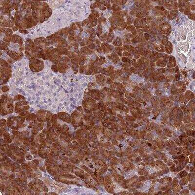 Immunohistochemistry-Paraffin: TLCD2 Antibody [NBP2-14562]