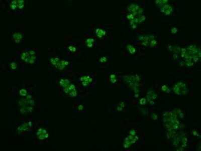 Immunocytochemistry/ Immunofluorescence: TLDC1 Antibody (OTI5D9) - Azide and BSA Free [NBP2-72091]