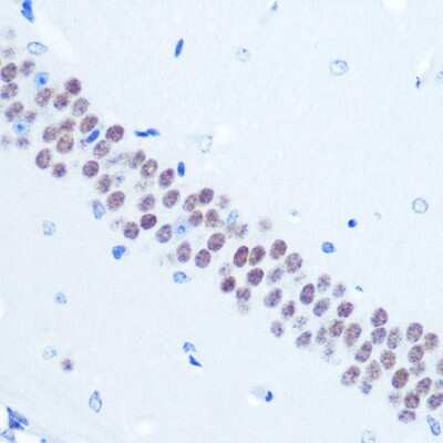 Immunohistochemistry-Paraffin: TLE1 Antibody (6Q5X1) [NBP3-16208]