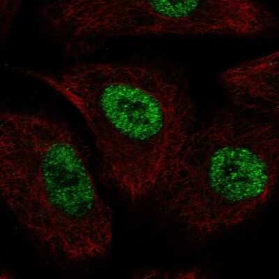 Immunocytochemistry/ Immunofluorescence: TLE1 Antibody [NBP2-56388]
