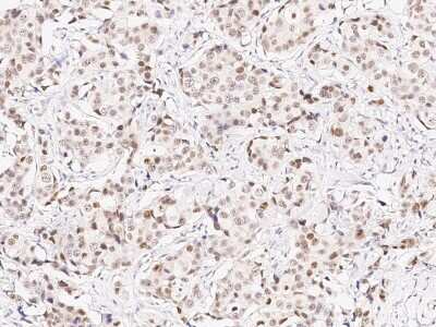 Immunohistochemistry-Paraffin: TLE1 Antibody [NBP2-98893]