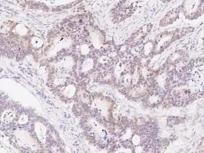 Immunohistochemistry-Paraffin: TLE1 Antibody [NBP2-98893]