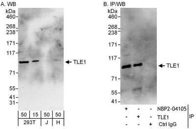 Immunoprecipitation: TLE1 Antibody [NBP2-04105]