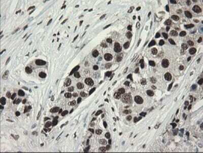 Immunohistochemistry: TLE1 Antibody (OTI1H2) - Azide and BSA Free [NBP2-74530]