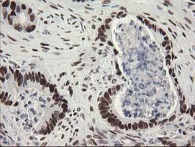 Immunohistochemistry: TLE1 Antibody (OTI1H2) - Azide and BSA Free [NBP2-74530]