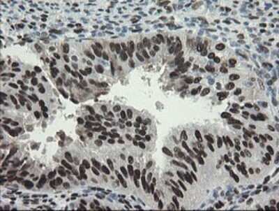 Immunohistochemistry: TLE1 Antibody (OTI1H2) - Azide and BSA Free [NBP2-74530]