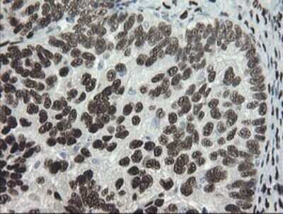 Immunohistochemistry: TLE1 Antibody (OTI1H2) - Azide and BSA Free [NBP2-74530]
