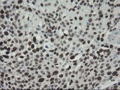 Immunohistochemistry: TLE1 Antibody (OTI1H2) - Azide and BSA Free [NBP2-74530]