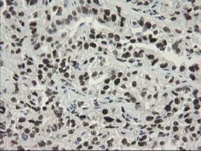 Immunohistochemistry: TLE1 Antibody (OTI1H2) - Azide and BSA Free [NBP2-74530]