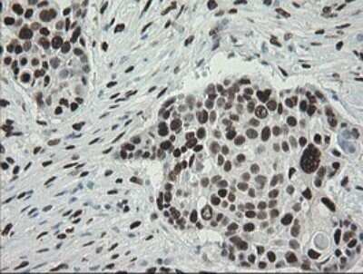 Immunohistochemistry: TLE1 Antibody (OTI1H2) - Azide and BSA Free [NBP2-74530]
