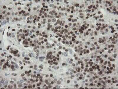 Immunohistochemistry: TLE1 Antibody (OTI1H2) - Azide and BSA Free [NBP2-74530]