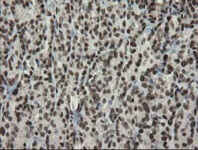 Immunohistochemistry: TLE1 Antibody (OTI1H2) - Azide and BSA Free [NBP2-74530]