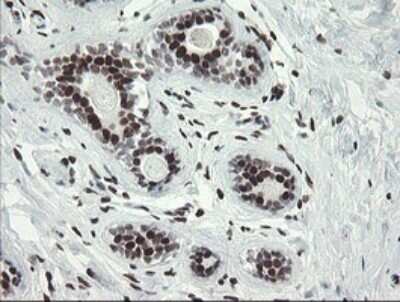 Immunohistochemistry: TLE1 Antibody (OTI1H2) - Azide and BSA Free [NBP2-74530]