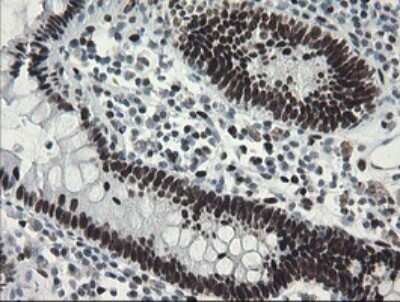 Immunohistochemistry: TLE1 Antibody (OTI1H2) - Azide and BSA Free [NBP2-74530]