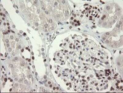 Immunohistochemistry: TLE1 Antibody (OTI1H2) - Azide and BSA Free [NBP2-74530]