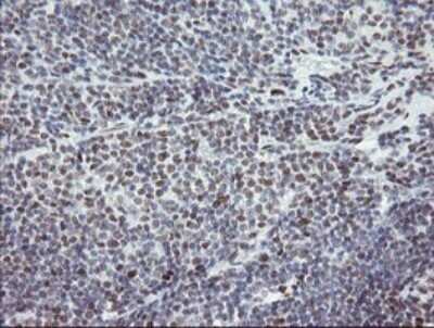 Immunohistochemistry: TLE1 Antibody (OTI1H2) - Azide and BSA Free [NBP2-74530]