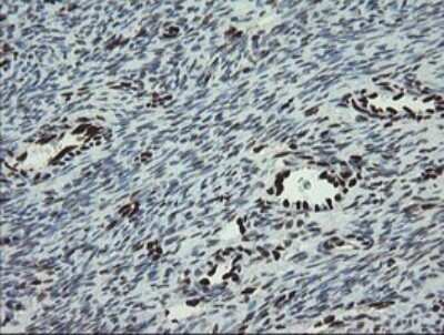 Immunohistochemistry: TLE1 Antibody (OTI1H2) - Azide and BSA Free [NBP2-74530]