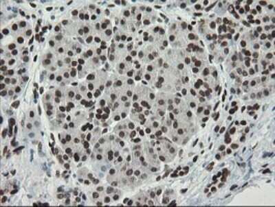 Immunohistochemistry: TLE1 Antibody (OTI1H2) - Azide and BSA Free [NBP2-74530]