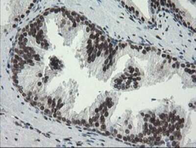 Immunohistochemistry: TLE1 Antibody (OTI1H2) - Azide and BSA Free [NBP2-74530]