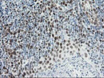 Immunohistochemistry: TLE1 Antibody (OTI1H2) - Azide and BSA Free [NBP2-74530]