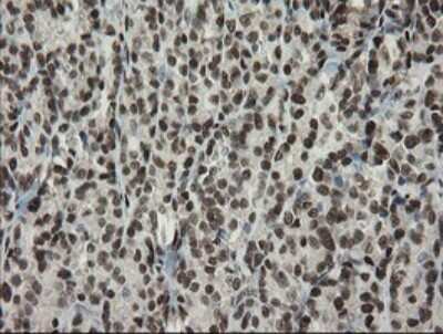 Immunohistochemistry: TLE1 Antibody (OTI1H2) [NBP2-46134]