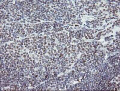 Immunohistochemistry: TLE1 Antibody (OTI1H2) [NBP2-46134]