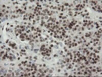 Immunohistochemistry: TLE1 Antibody (OTI1H2) [NBP2-46134]