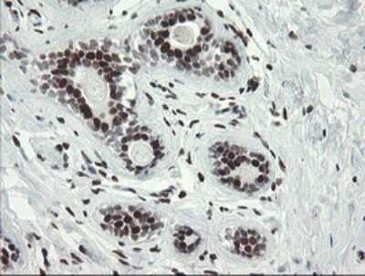 Immunohistochemistry: TLE1 Antibody (OTI1H2) [NBP2-46134]