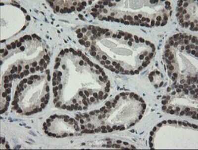 Immunohistochemistry: TLE1 Antibody (OTI1H2) [NBP2-46134]