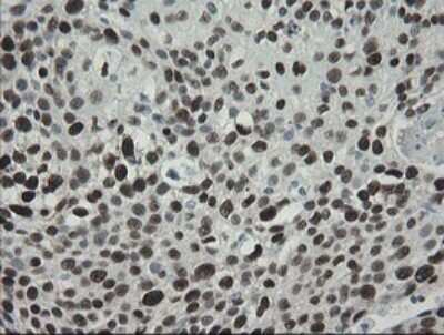 Immunohistochemistry: TLE1 Antibody (OTI1H2) [NBP2-46134]