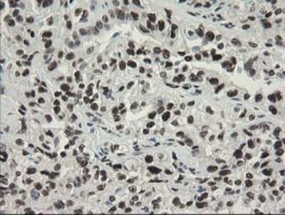 Immunohistochemistry: TLE1 Antibody (OTI1H2) [NBP2-46134]